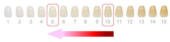 STEP2歯の色を測定